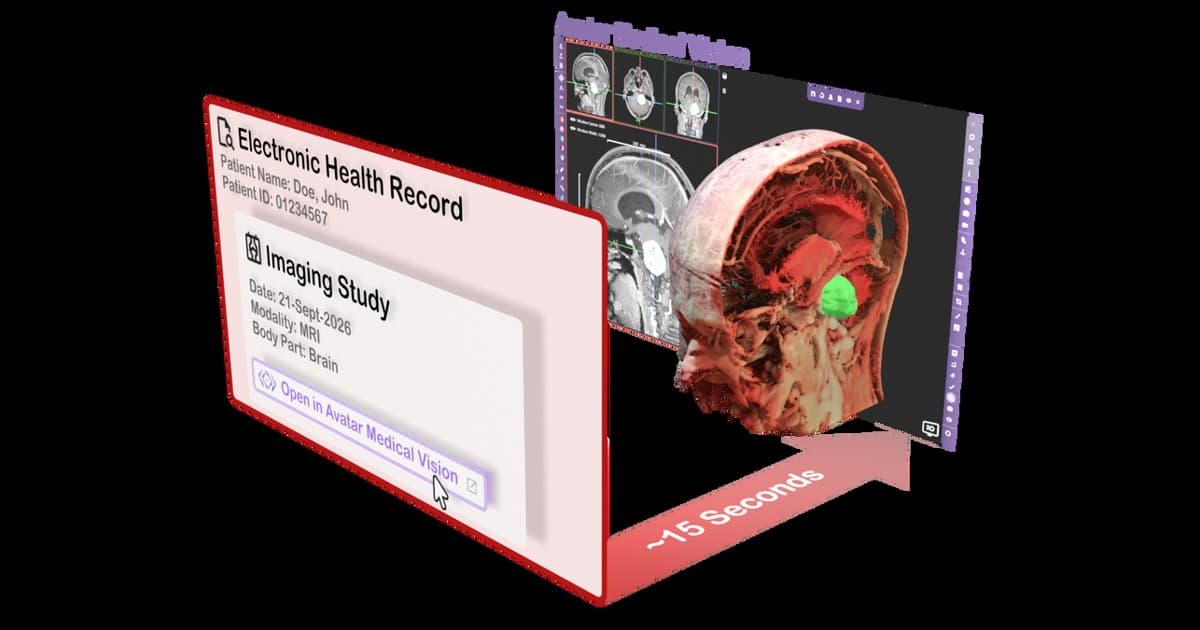 Avatar Medical Brings Interactive 3D of a Patient's Own Anatomy to the Clinic Even Faster with New Epic Integration